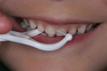 floss 2